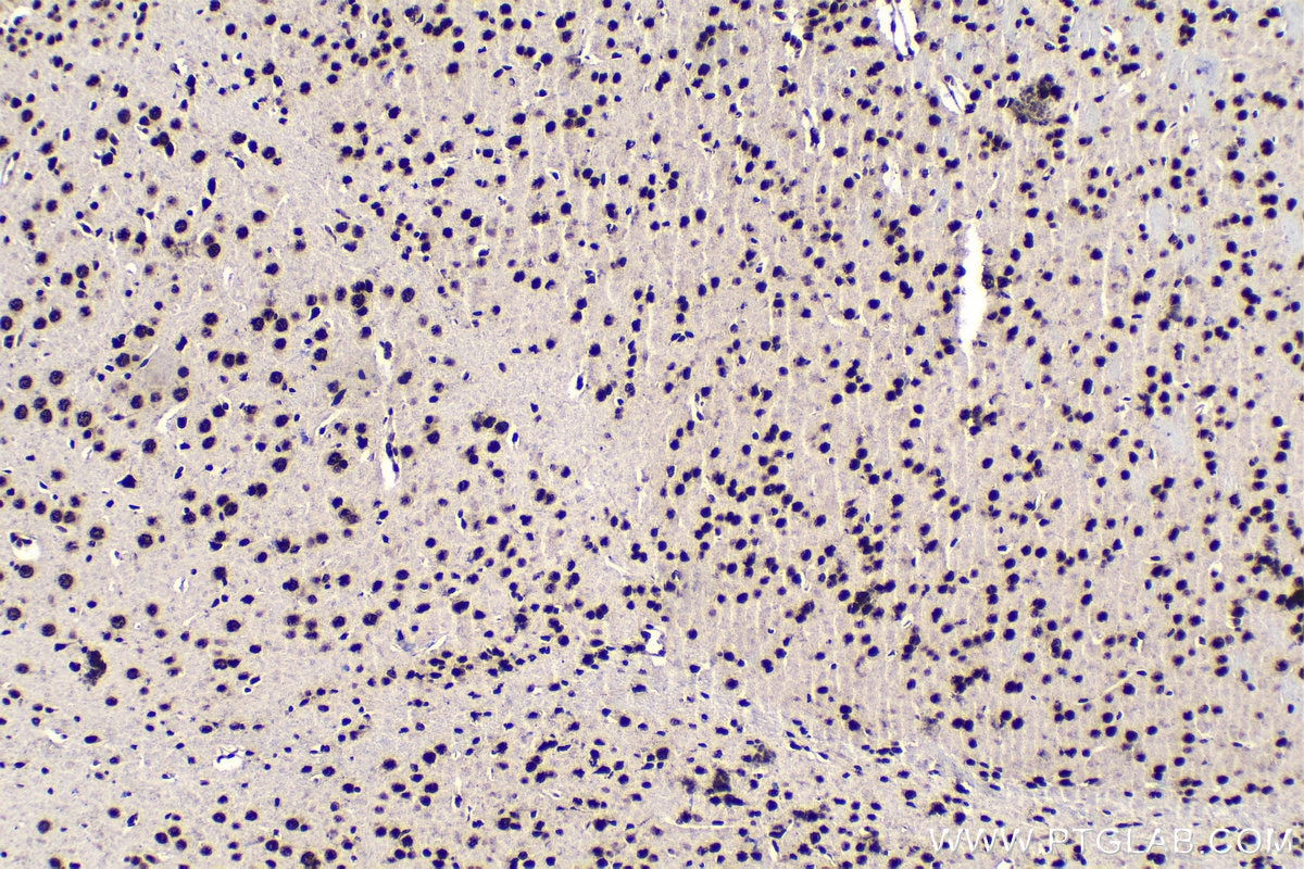 Immunohistochemical analysis of paraffin-embedded mouse brain tissue slide using KHC1588 (EIF4A3 IHC Kit).