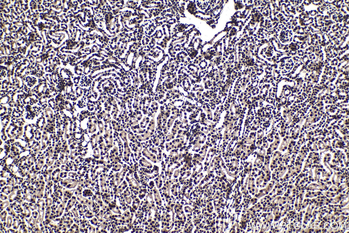 Immunohistochemical analysis of paraffin-embedded mouse kidney tissue slide using KHC1588 (EIF4A3 IHC Kit).