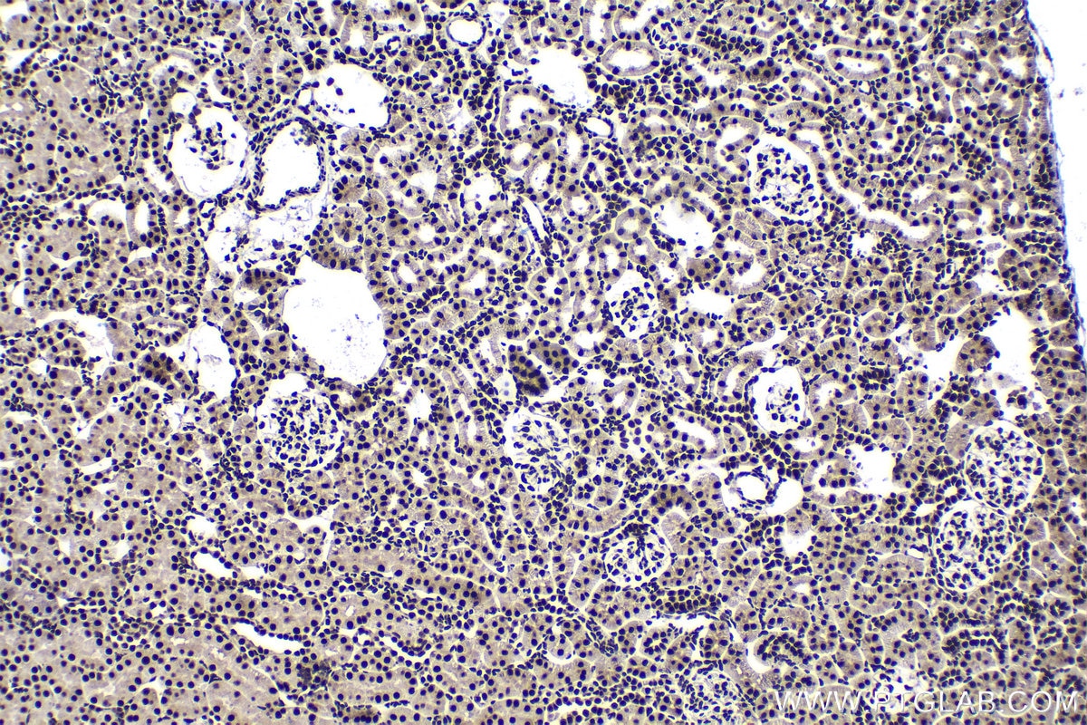 Immunohistochemical analysis of paraffin-embedded rat kidney tissue slide using KHC1588 (EIF4A3 IHC Kit).