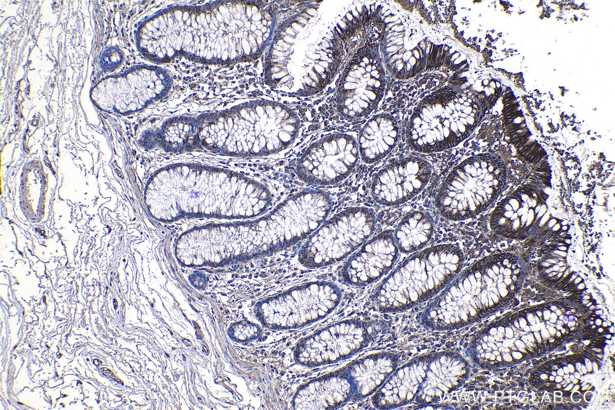 Immunohistochemical analysis of paraffin-embedded human colon tissue slide using KHC1206 (EIF4G1 IHC Kit).