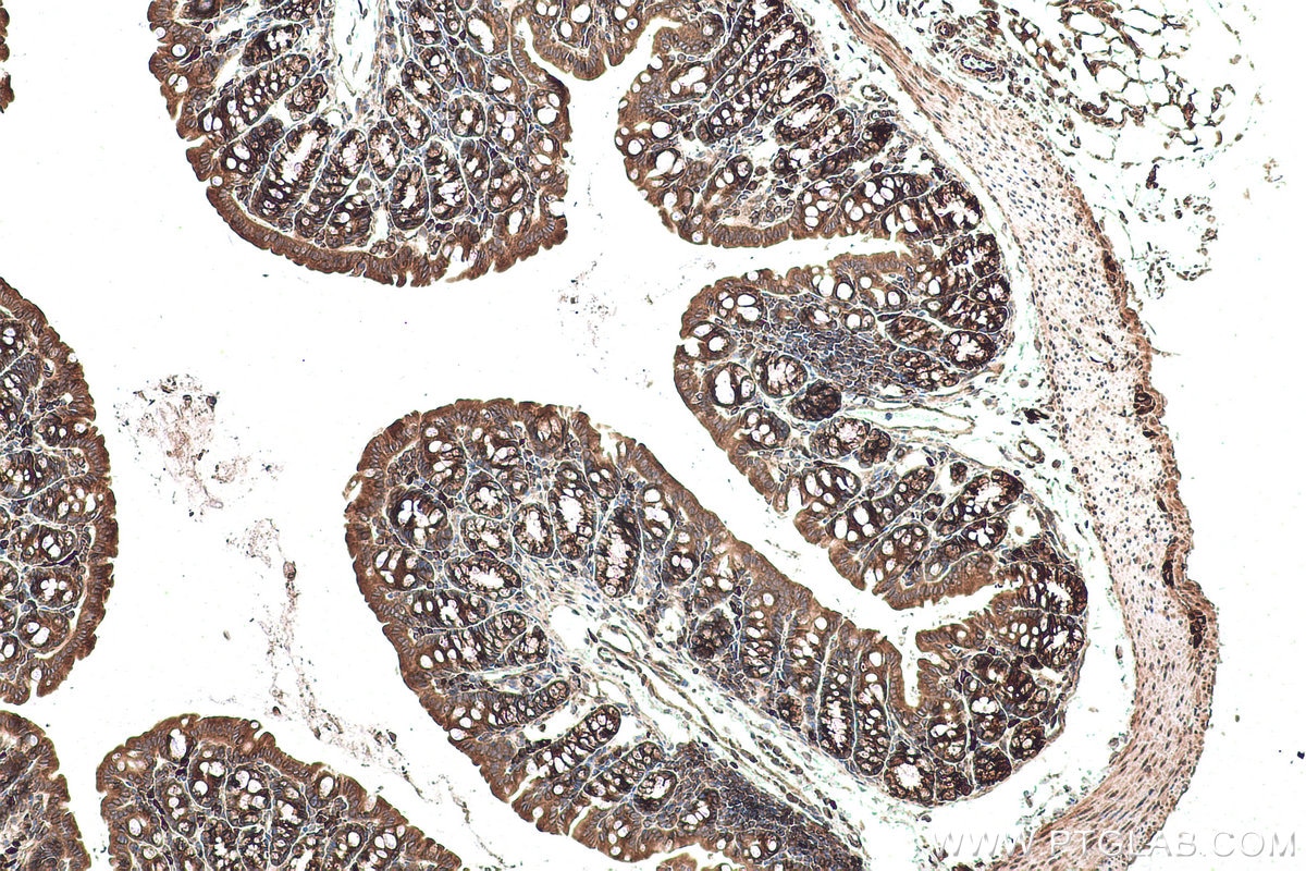 Immunohistochemical analysis of paraffin-embedded mouse colon tissue slide using KHC0927 (EIF4G2 IHC Kit).