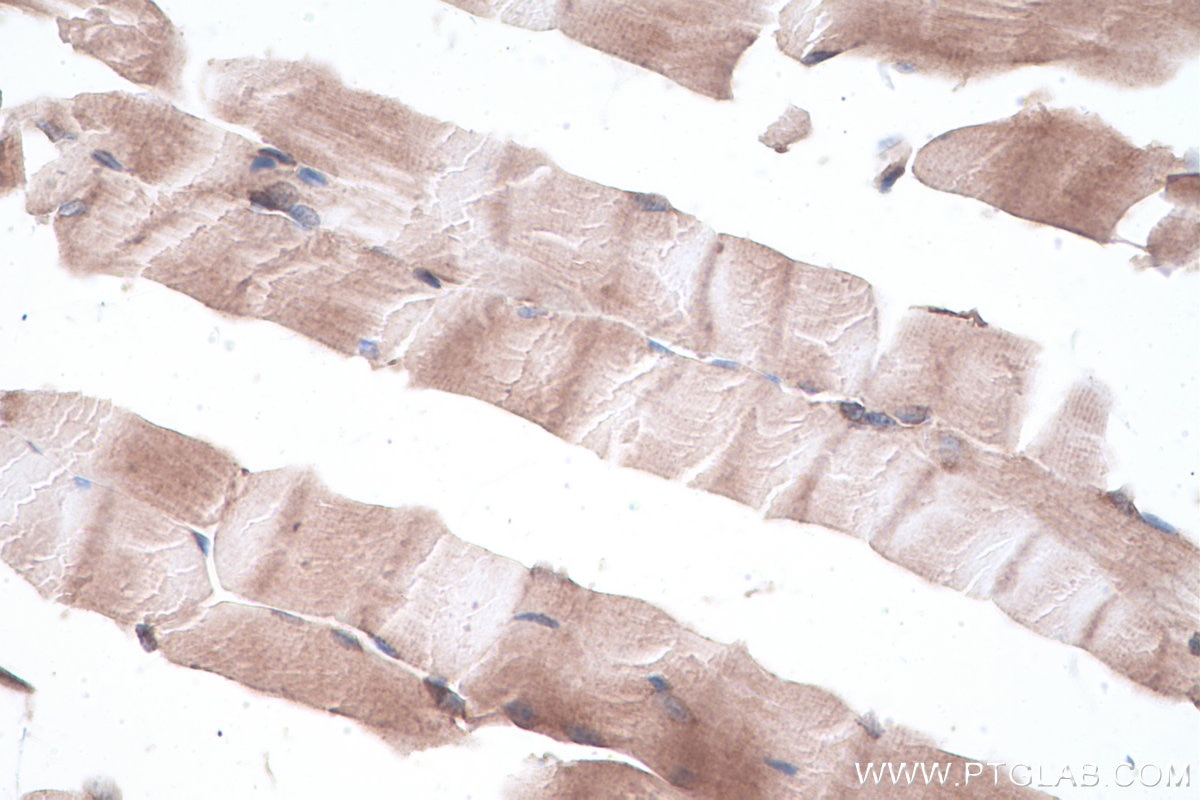 Immunohistochemical analysis of paraffin-embedded mouse skeletal muscle tissue slide using KHC0927 (EIF4G2 IHC Kit).