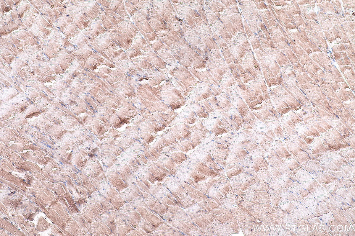 Immunohistochemical analysis of paraffin-embedded rat skeletal muscle tissue slide using KHC0927 (EIF4G2 IHC Kit).