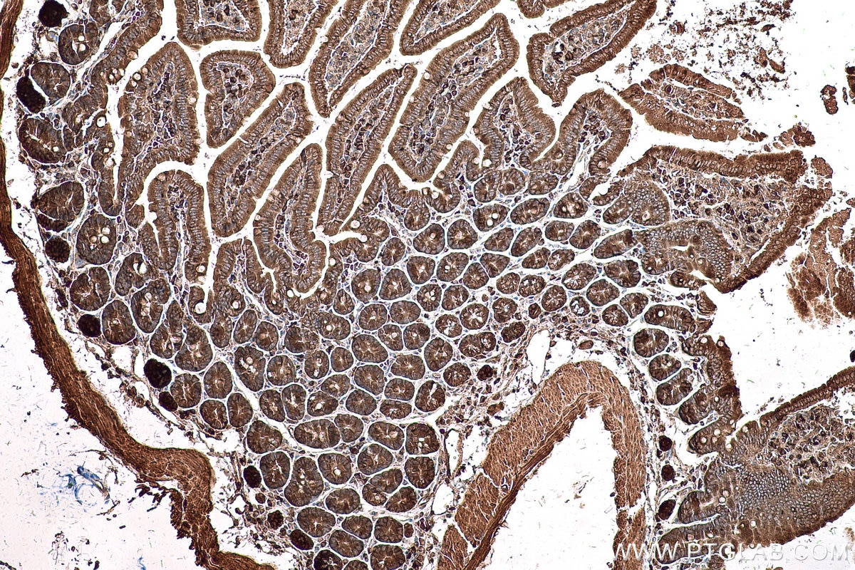 Immunohistochemical analysis of paraffin-embedded mouse small intestine tissue slide using KHC0596 (EIF5A IHC Kit).