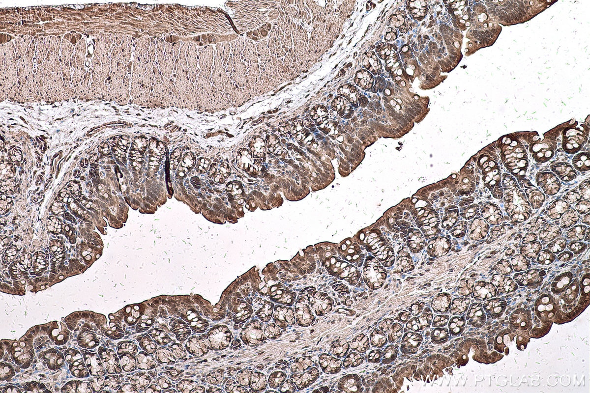 Immunohistochemical analysis of paraffin-embedded rat colon tissue slide using KHC0596 (EIF5A IHC Kit).