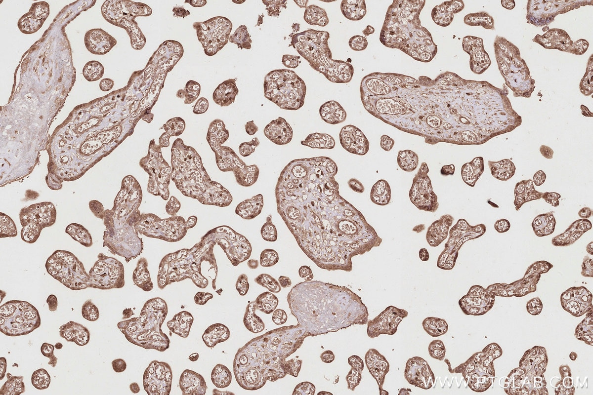 Immunohistochemical analysis of paraffin-embedded human placenta tissue slide using KHC2896 (EIF5A1/EIF5A2 IHC Kit).