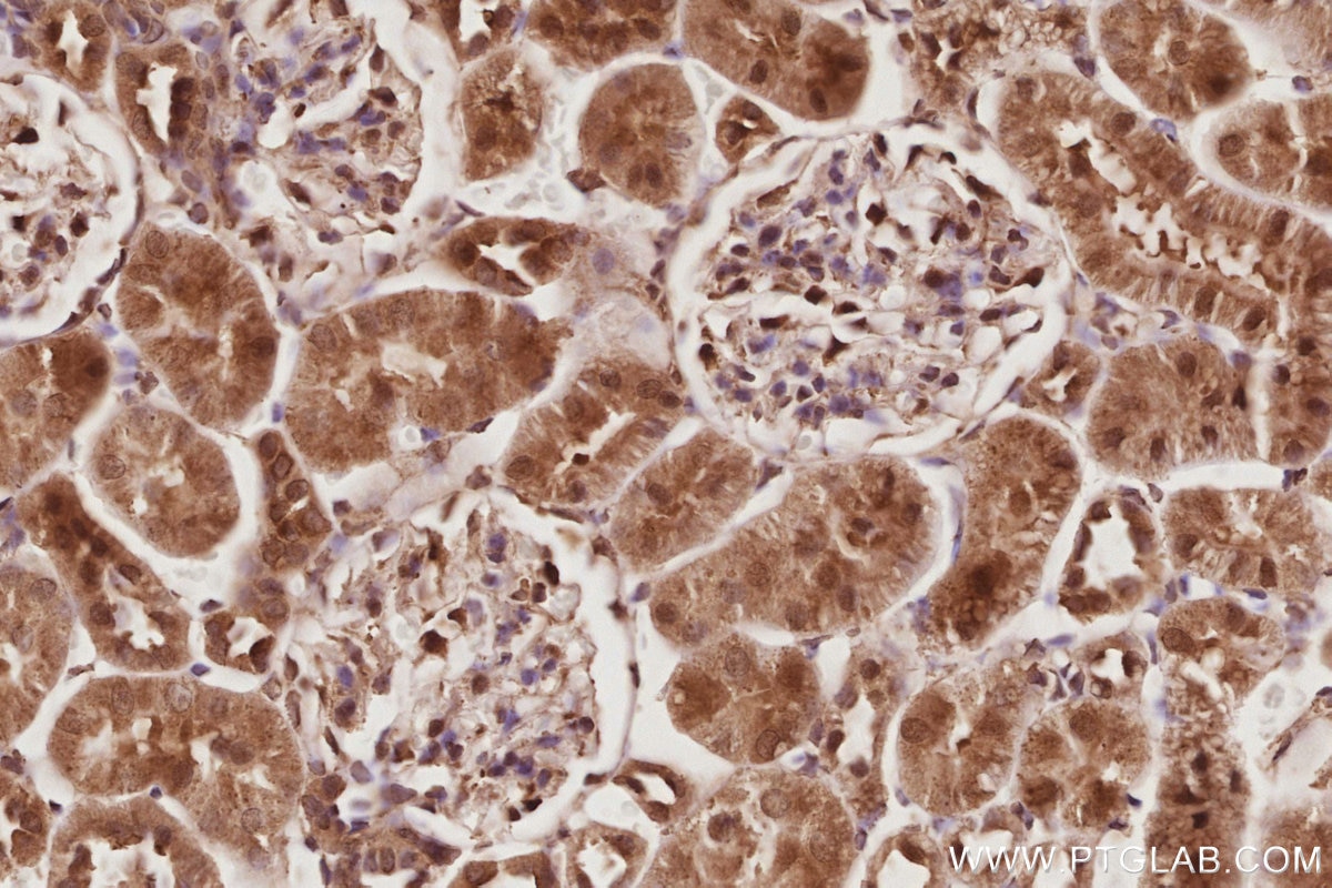 Immunohistochemical analysis of paraffin-embedded rat kidney tissue slide using KHC2896 (EIF5A1/EIF5A2 IHC Kit).