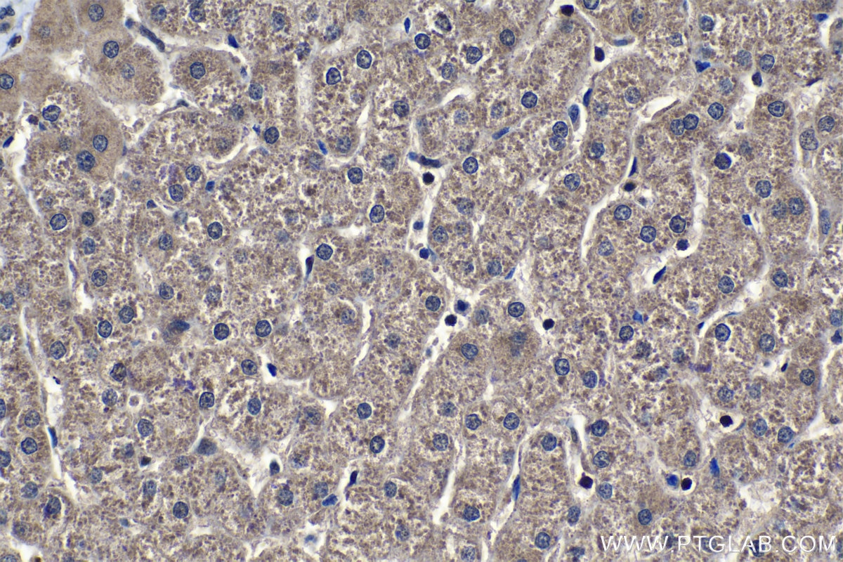 Immunohistochemical analysis of paraffin-embedded human liver tissue slide using KHC1107 (ELAC2 IHC Kit).
