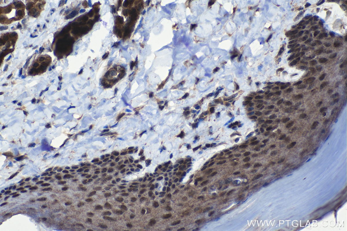 Immunohistochemical analysis of paraffin-embedded mouse skin tissue slide using KHC1107 (ELAC2 IHC Kit).