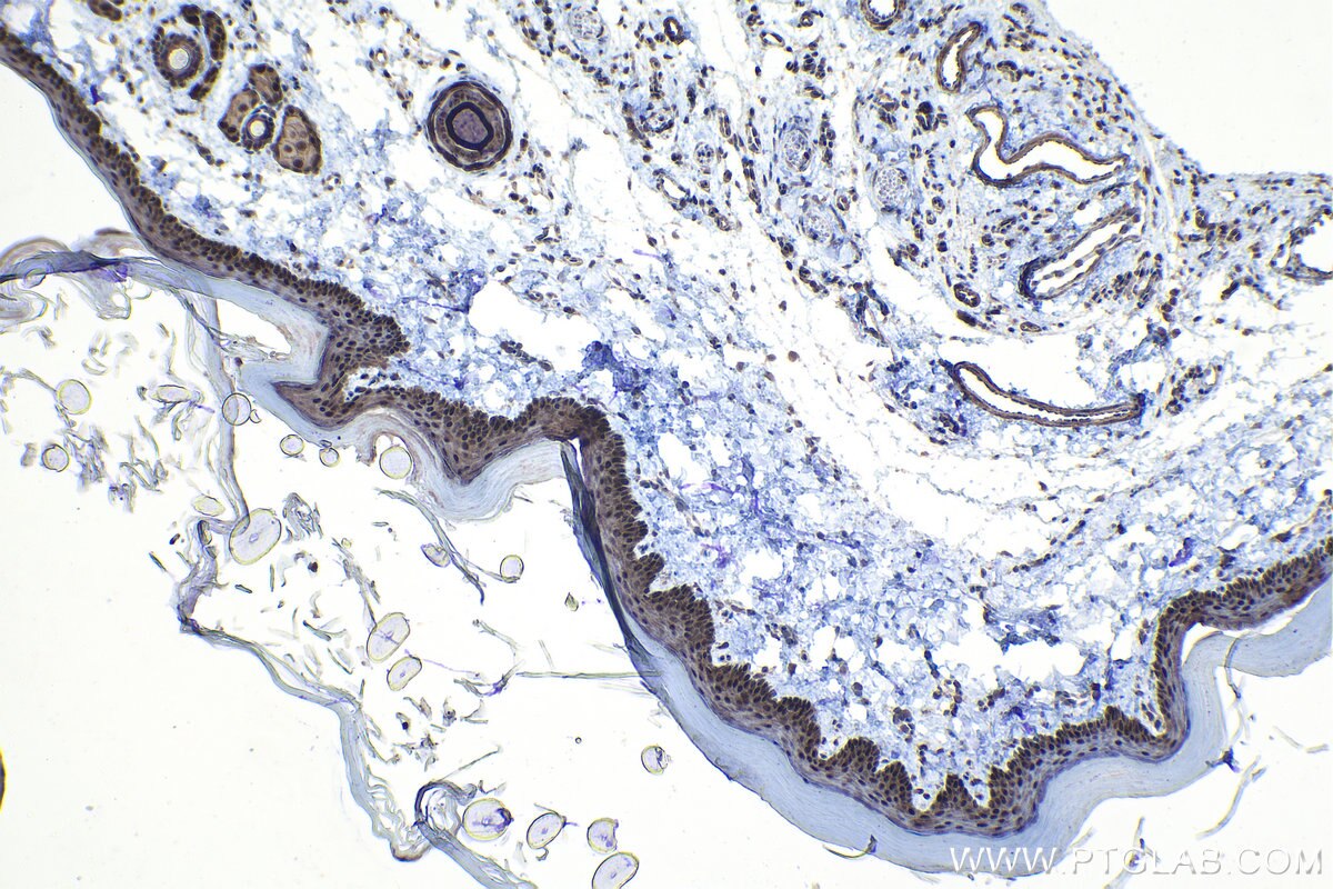 Immunohistochemical analysis of paraffin-embedded rat skin tissue slide using KHC1107 (ELAC2 IHC Kit).