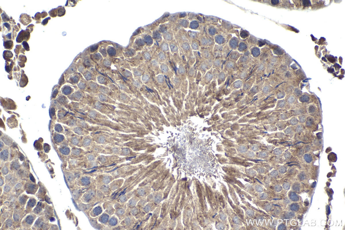 Immunohistochemical analysis of paraffin-embedded rat testis tissue slide using KHC1345 (ELOVL2 IHC Kit).