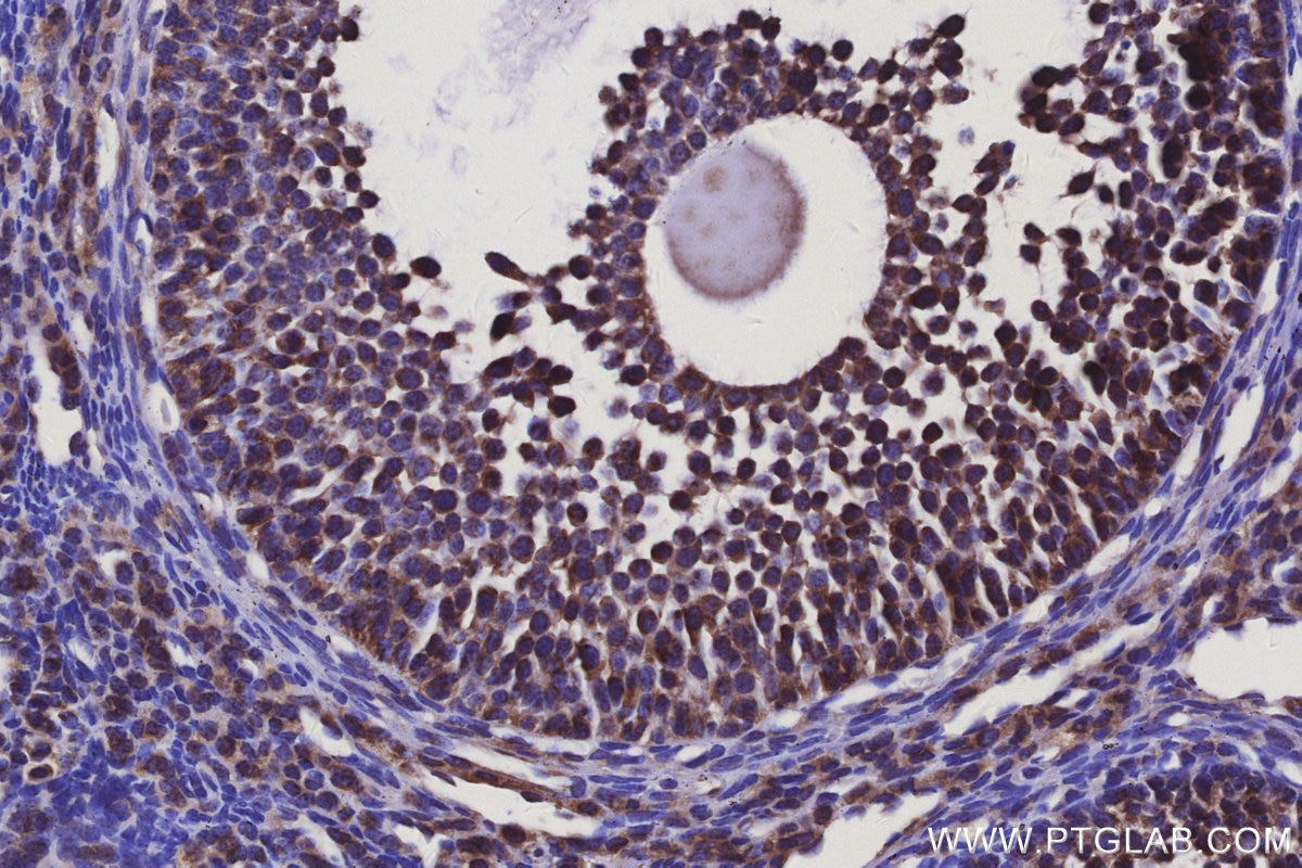 Immunohistochemical analysis of paraffin-embedded mouse ovary tissue slide using KHC3133 (ELOVL7 IHC Kit).