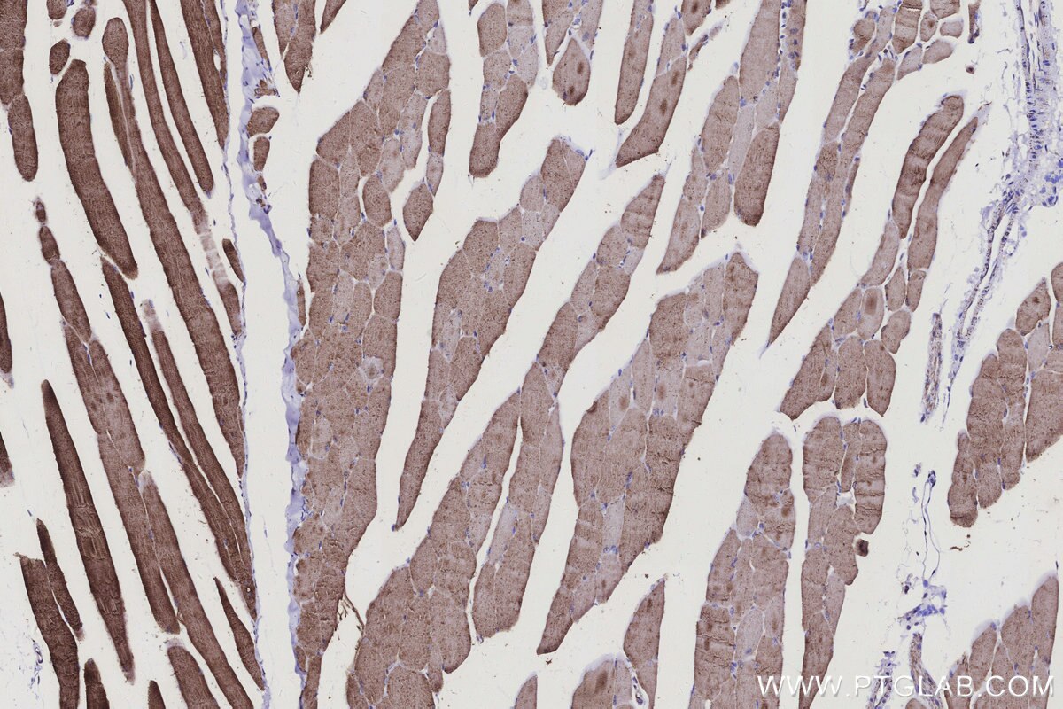 Immunohistochemical analysis of paraffin-embedded mouse skeletal muscle tissue slide using KHC3133 (ELOVL7 IHC Kit).