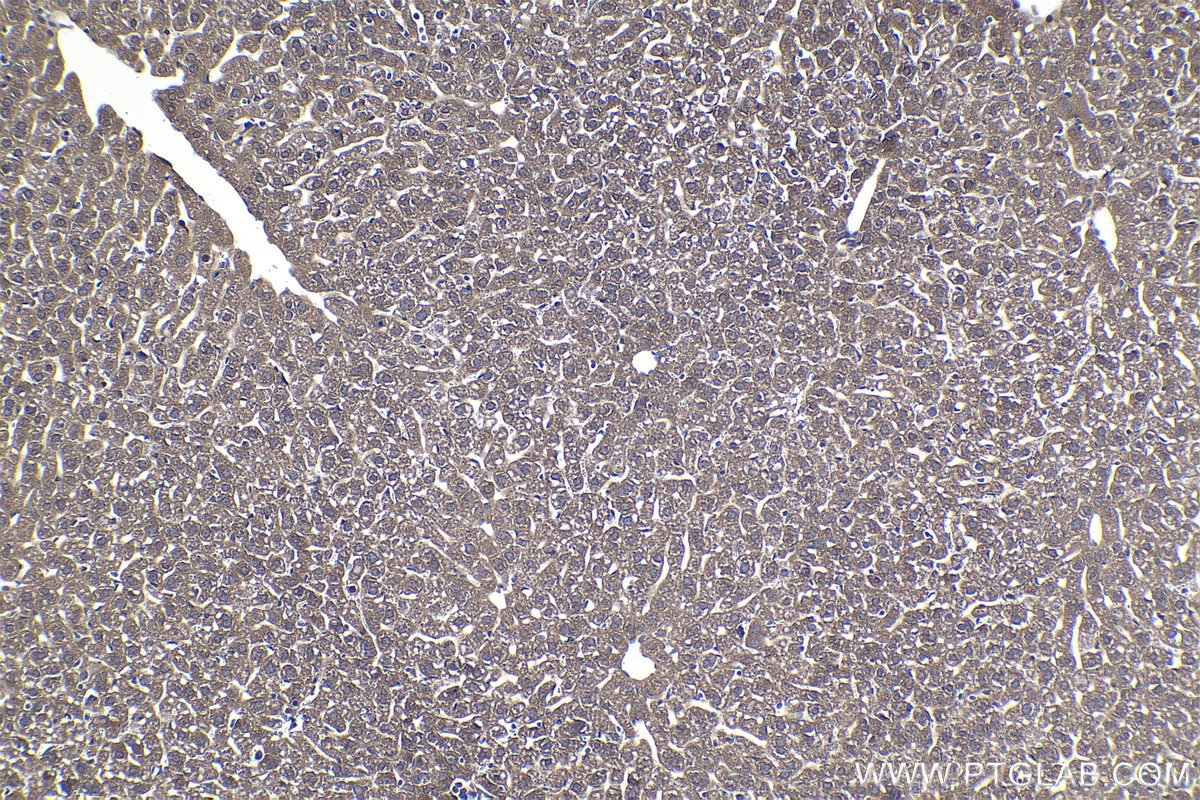 Immunohistochemical analysis of paraffin-embedded mouse liver tissue slide using KHC1020 (ELP2 IHC Kit).