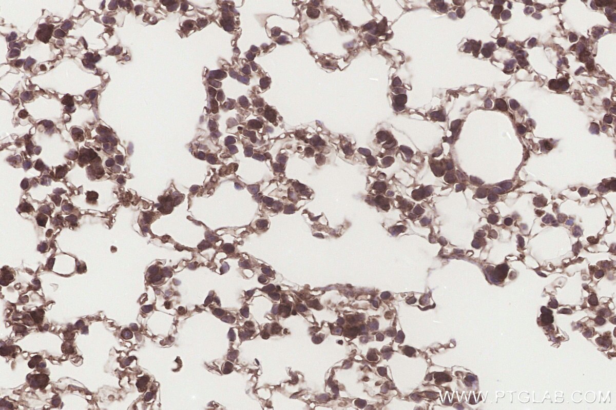 Immunohistochemical analysis of paraffin-embedded mouse lung tissue slide using KHC3254 (EMC2/TTC35 IHC Kit). Immunohistochemical analysis of paraffin-embedded mouse lung tissue slide using KHC3254 (EMC2/TTC35 IHC Kit).
