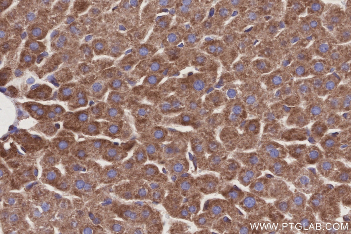 Immunohistochemical analysis of paraffin-embedded rat liver tissue slide using KHC2931 (EML4 IHC Kit). Immunohistochemical analysis of paraffin-embedded rat liver tissue slide using KHC2931 (EML4 IHC Kit).