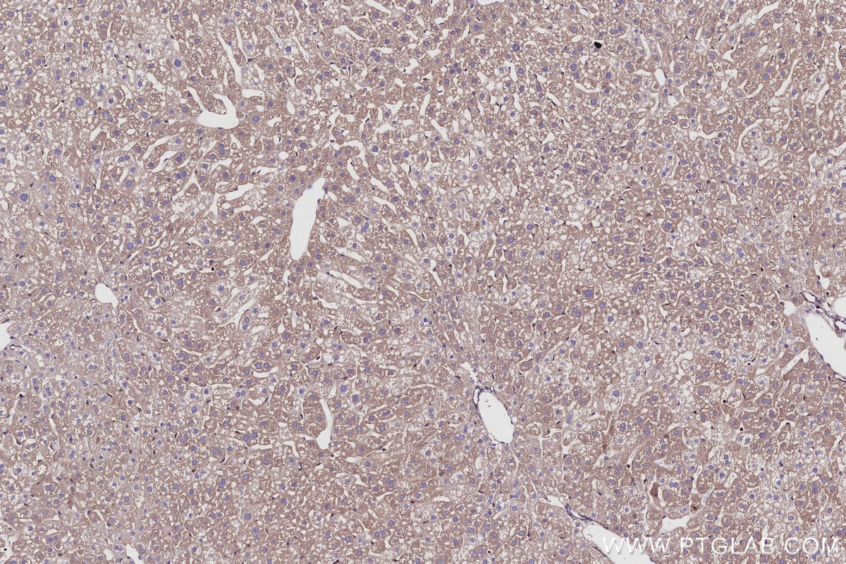 Immunohistochemical analysis of paraffin-embedded mouse liver tissue slide using KHC2931 (EML4 IHC Kit). Immunohistochemical analysis of paraffin-embedded mouse liver tissue slide using KHC2931 (EML4 IHC Kit).