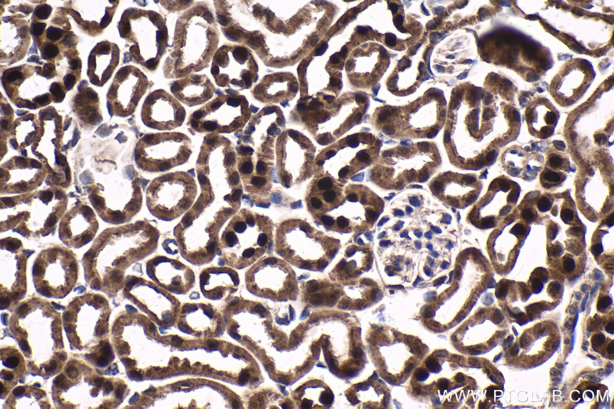 Immunohistochemical analysis of paraffin-embedded mouse kidney tissue slide using KHC1674 (EMX1 IHC Kit).