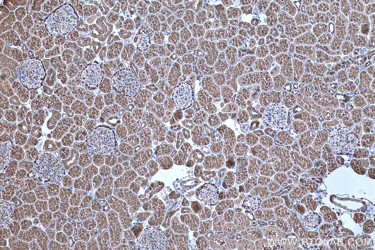 Immunohistochemical analysis of paraffin-embedded rat kidney tissue slide using KHC0656 (ENO1 IHC Kit).