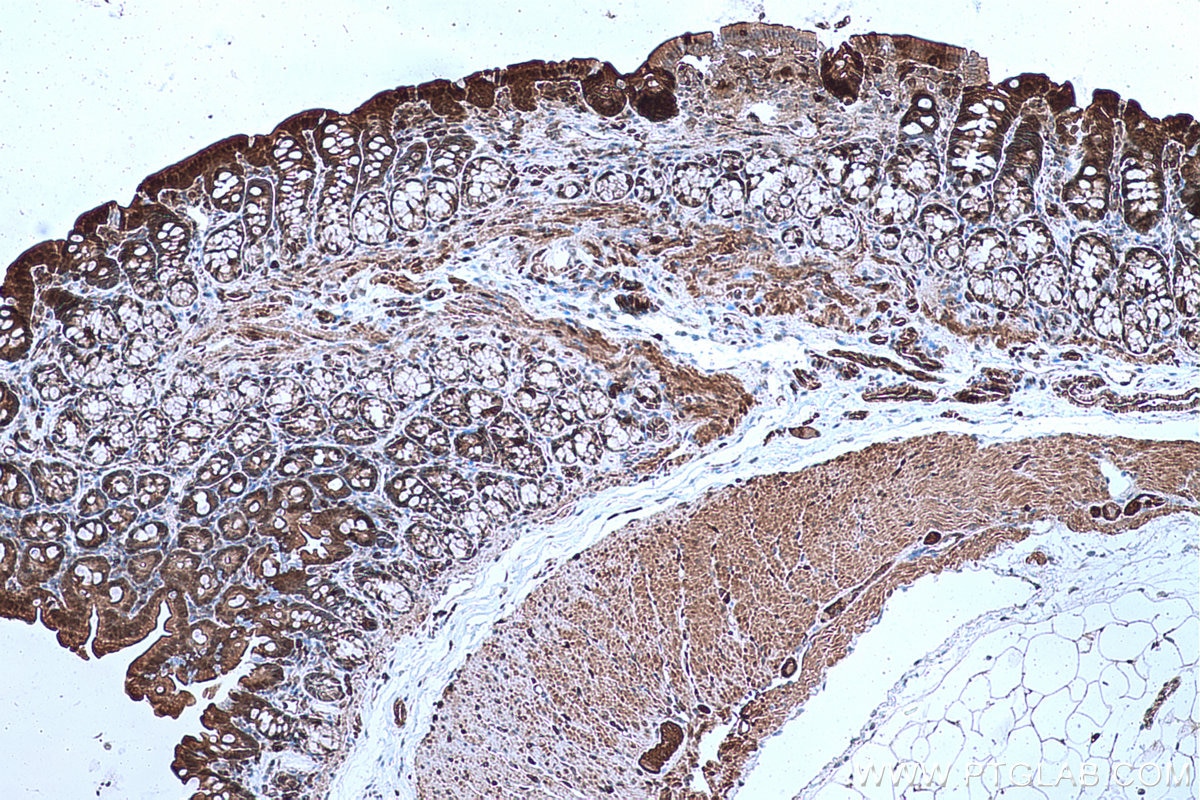 Immunohistochemical analysis of paraffin-embedded rat colon tissue slide using KHC0656 (ENO1 IHC Kit).