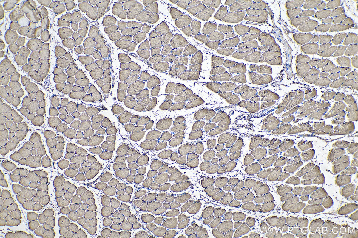 Immunohistochemical analysis of paraffin-embedded mouse skeletal muscle tissue slide using KHC0587 (ENO3 IHC Kit).