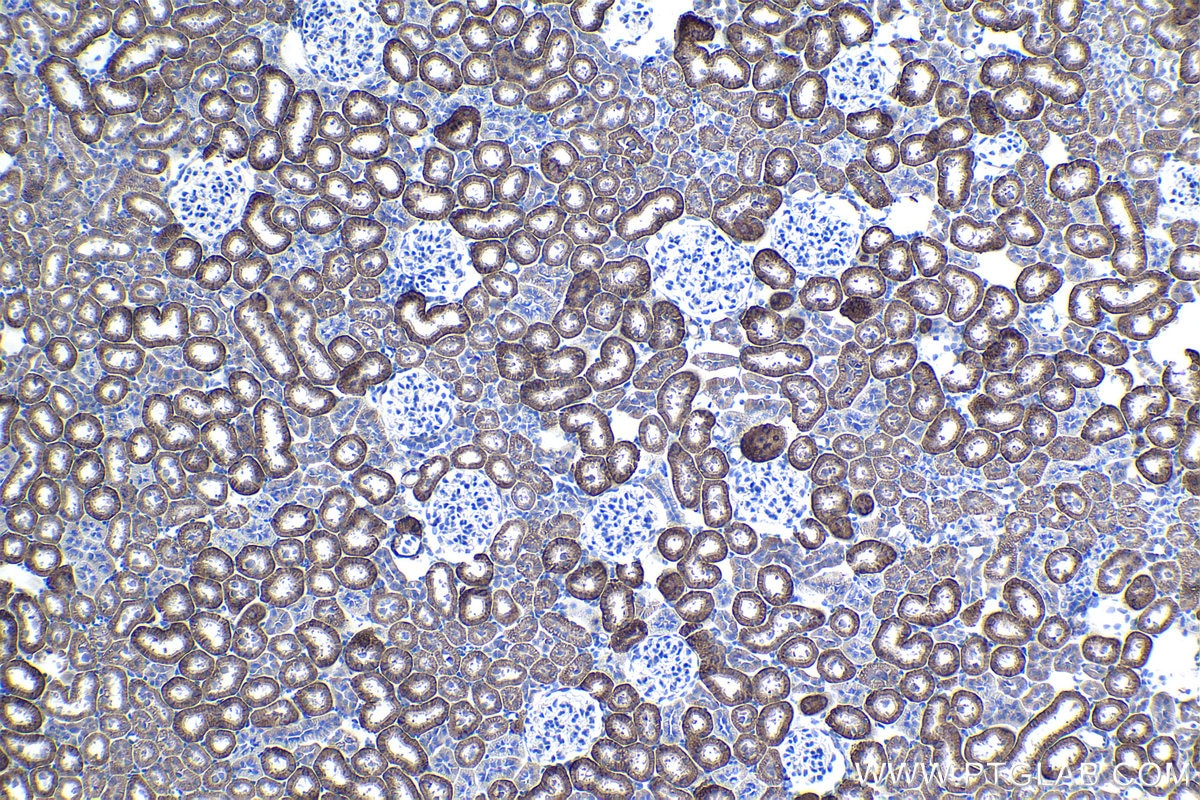 Immunohistochemical analysis of paraffin-embedded rat kidney tissue slide using KHC1082 (EPB41L3 IHC Kit).