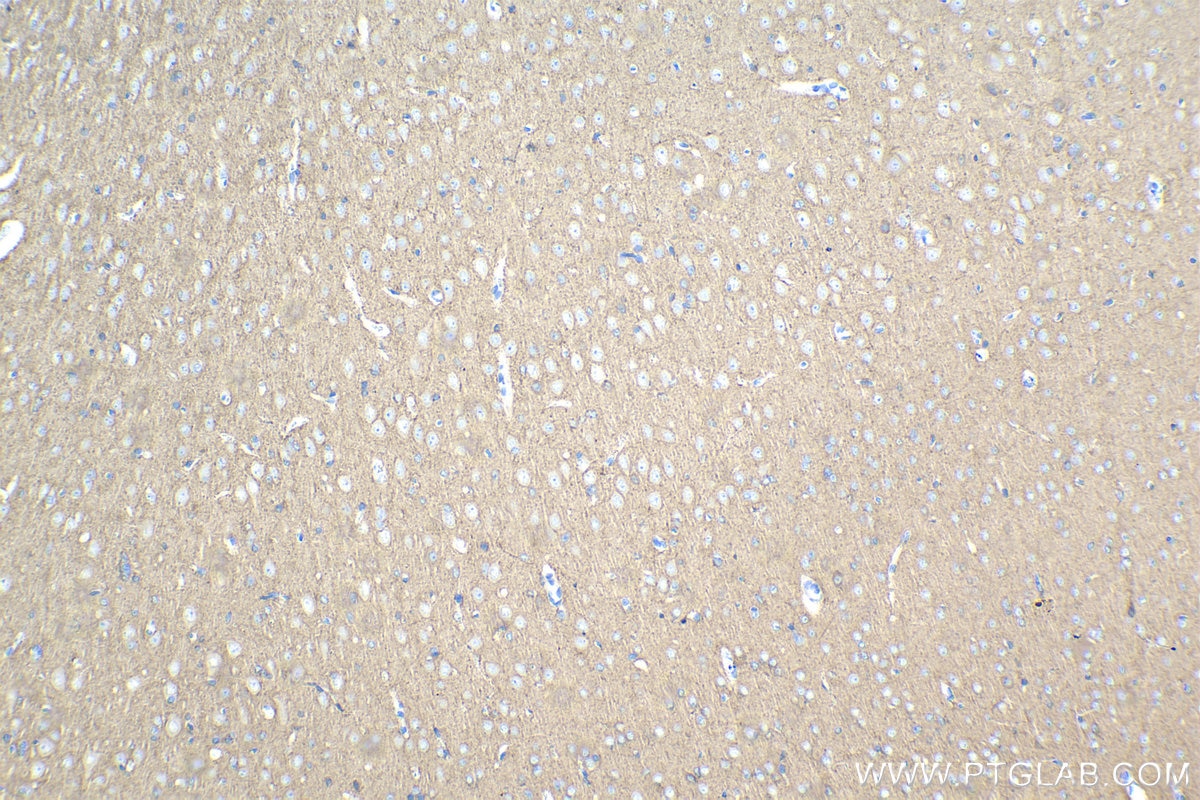 Immunohistochemical analysis of paraffin-embedded rat brain tissue slide using KHC1082 (EPB41L3 IHC Kit).