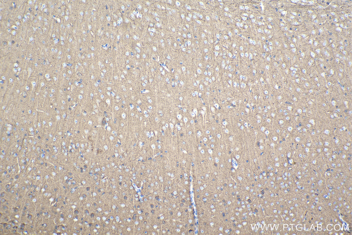 Immunohistochemical analysis of paraffin-embedded mouse brain tissue slide using KHC1082 (EPB41L3 IHC Kit).