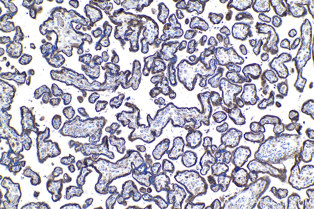 Immunohistochemical analysis of paraffin-embedded human placenta tissue slide using KHC1082 (EPB41L3 IHC Kit).