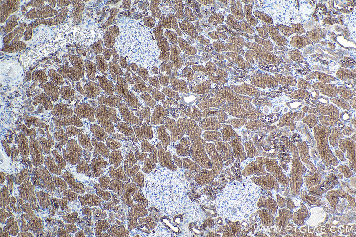 Immunohistochemical analysis of paraffin-embedded human kidney tissue slide using KHC1082 (EPB41L3 IHC Kit).