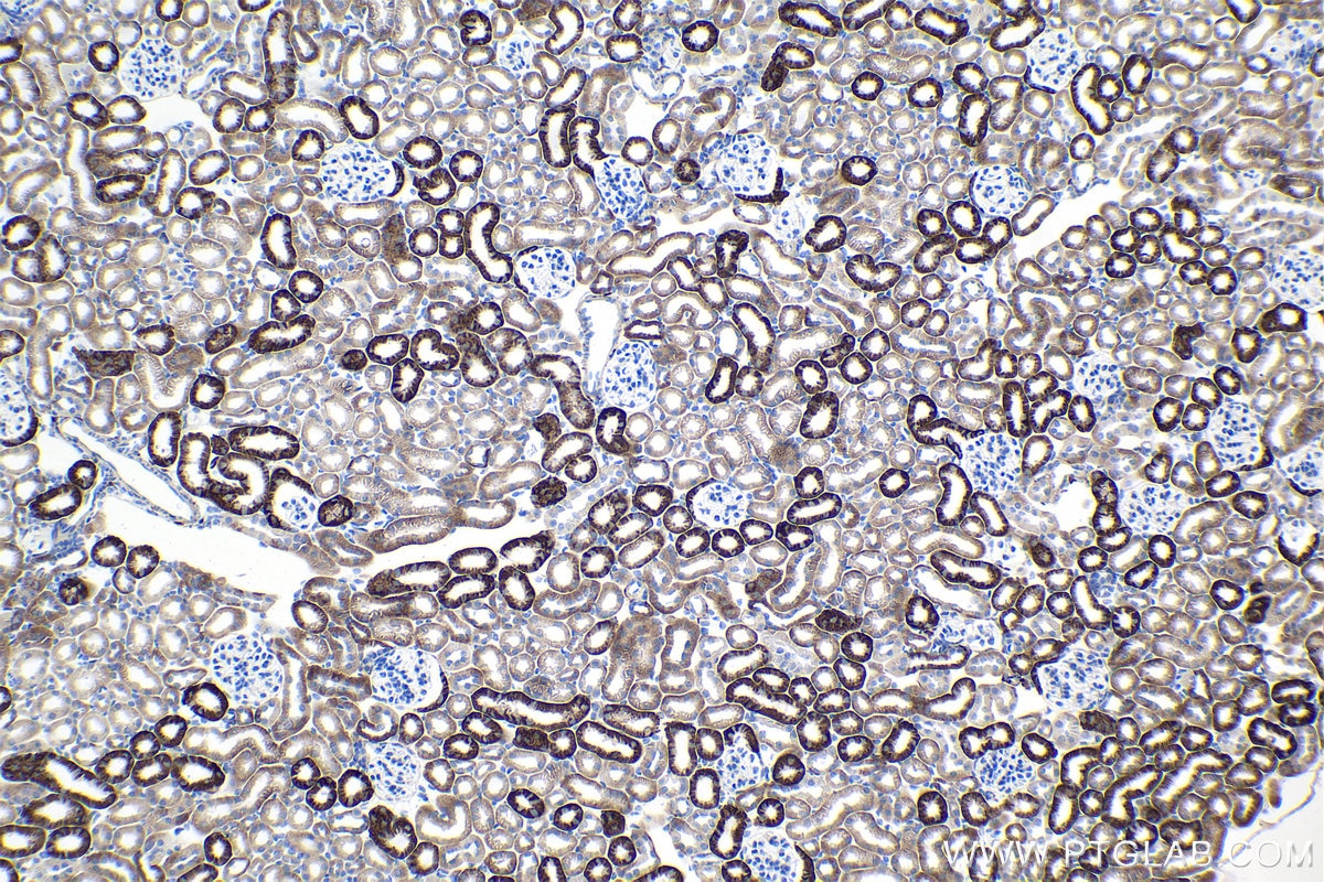 Immunohistochemical analysis of paraffin-embedded mouse kidney tissue slide using KHC1082 (EPB41L3 IHC Kit).