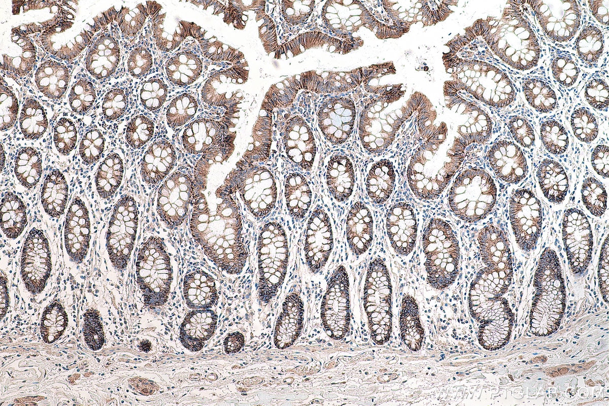 Immunohistochemical analysis of paraffin-embedded human colon tissue slide using KHC0085 (EPCAM IHC Kit).