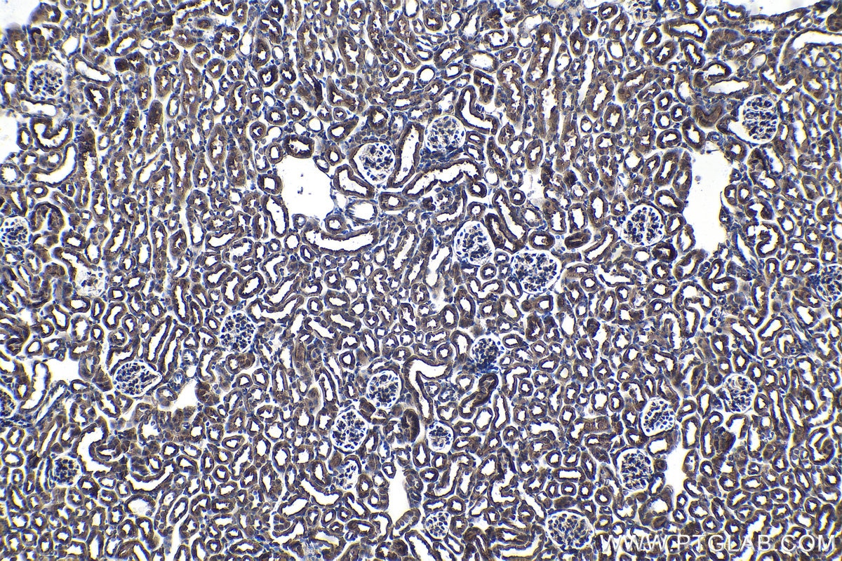 Immunohistochemical analysis of paraffin-embedded mouse kidney tissue slide using KHC1437 (EPHX2 IHC Kit).