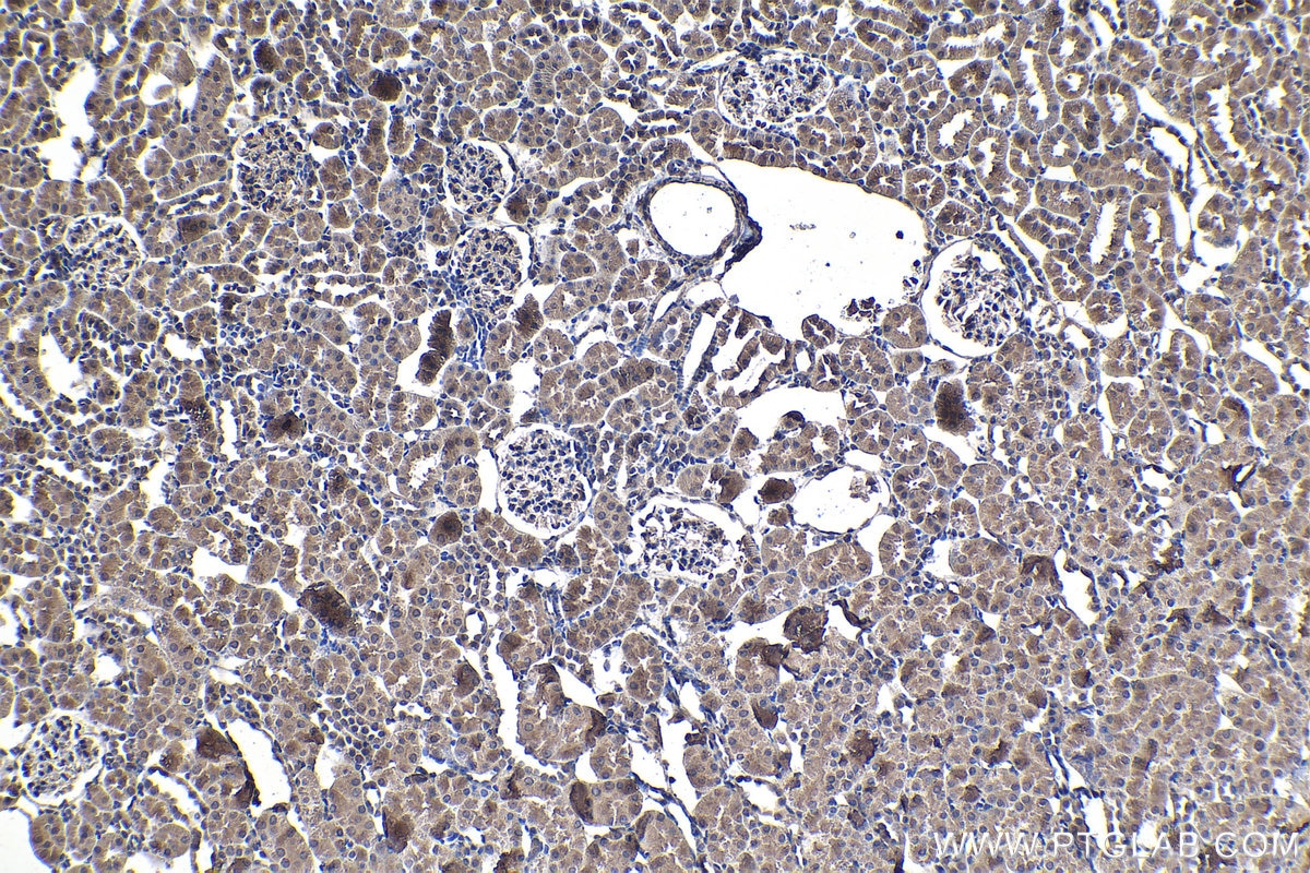 Immunohistochemical analysis of paraffin-embedded rat kidney tissue slide using KHC1437 (EPHX2 IHC Kit).