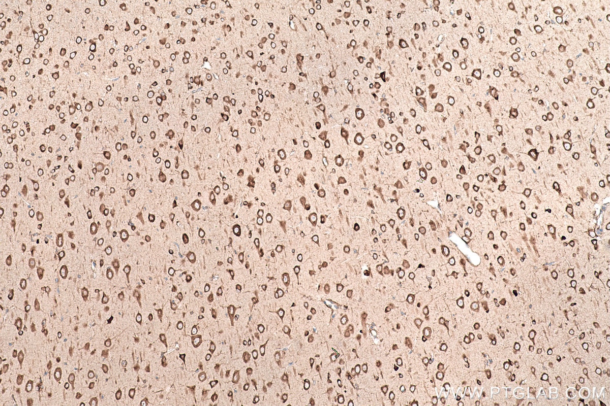 Immunohistochemical analysis of paraffin-embedded rat brain tissue slide using KHC0869 (EPRS IHC Kit).