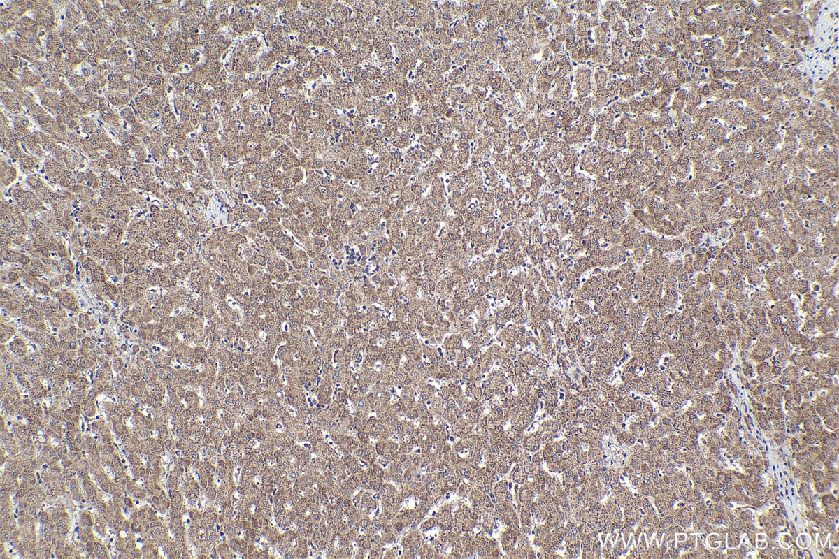 Immunohistochemical analysis of paraffin-embedded human liver tissue slide using KHC1883 (ERBIN IHC Kit).