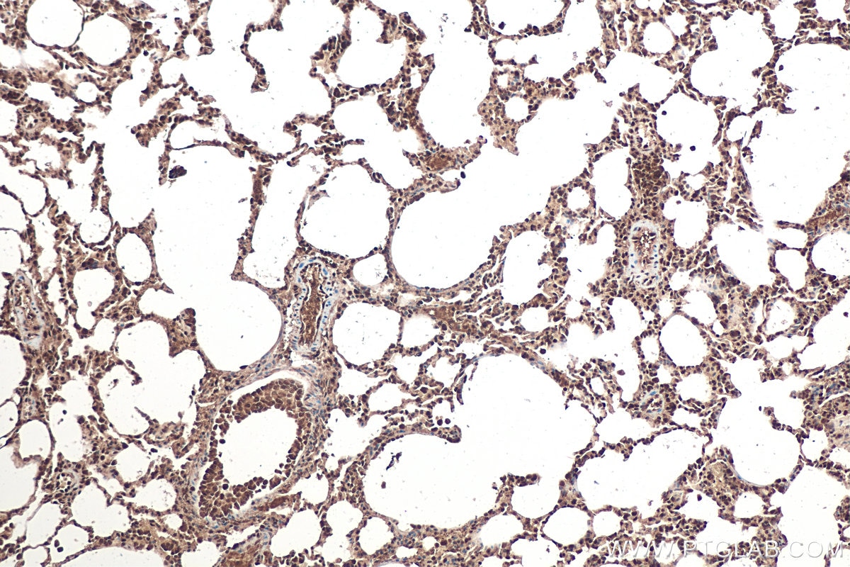 Immunohistochemical analysis of paraffin-embedded rat lung tissue slide using KHC0917 (ERK1/2 IHC Kit).