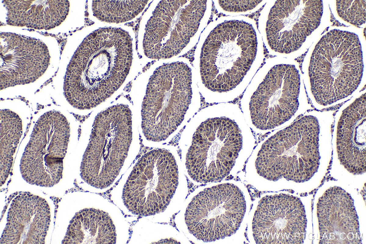 Immunohistochemical analysis of paraffin-embedded rat testis tissue slide using KHC1525 (ESRRA IHC Kit).