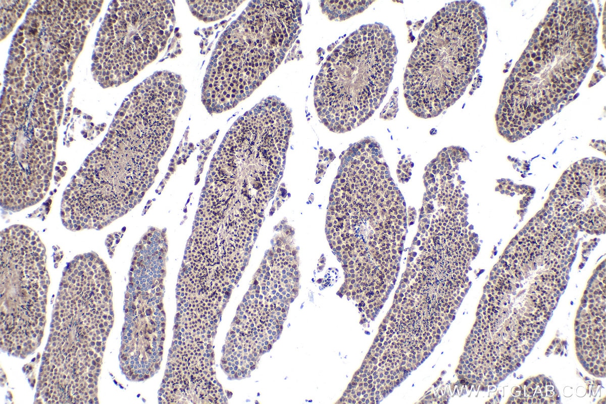 Immunohistochemical analysis of paraffin-embedded mouse testis tissue slide using KHC1525 (ESRRA IHC Kit).