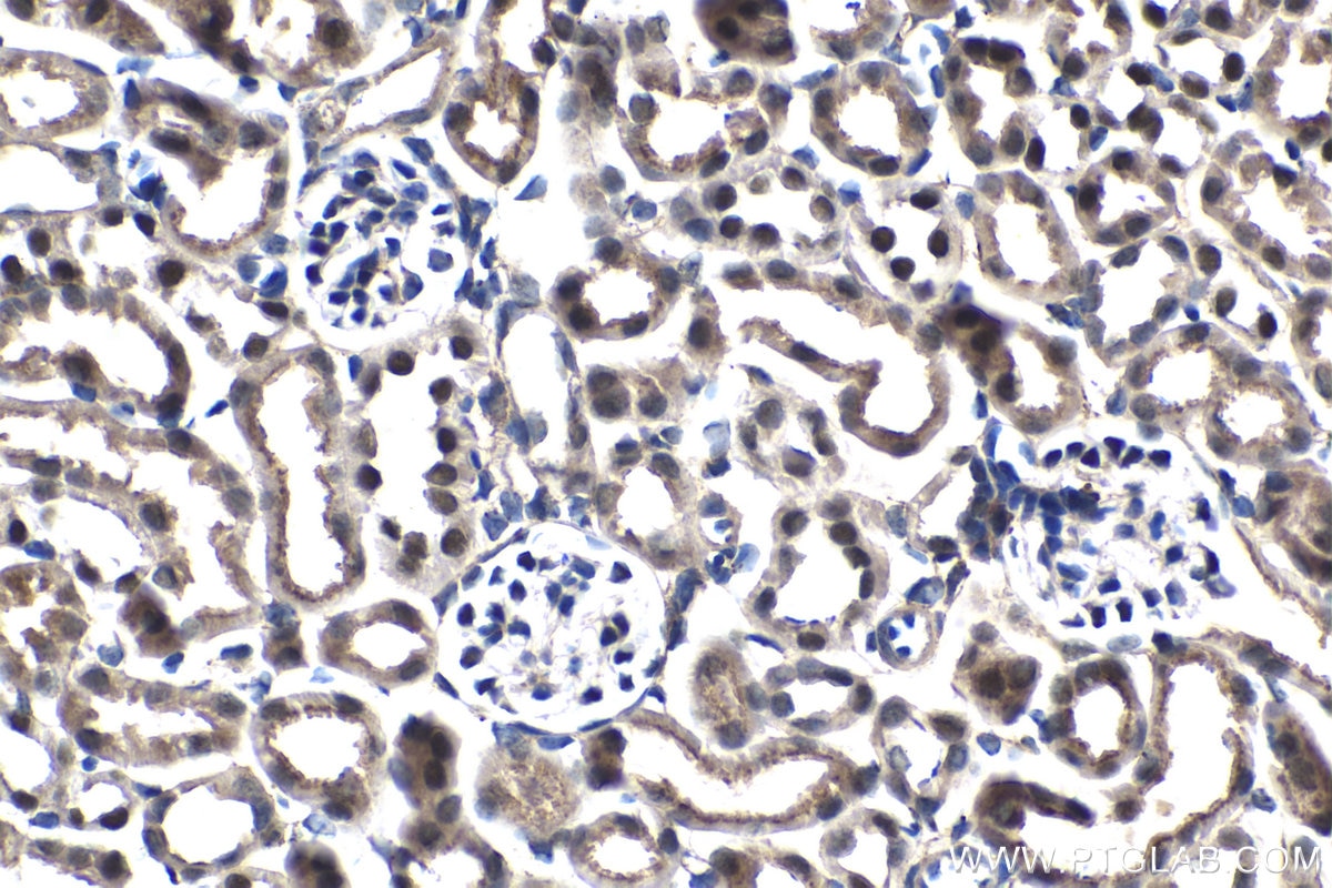Immunohistochemical analysis of paraffin-embedded mouse kidney tissue slide using KHC1499 (ESRRB IHC Kit).