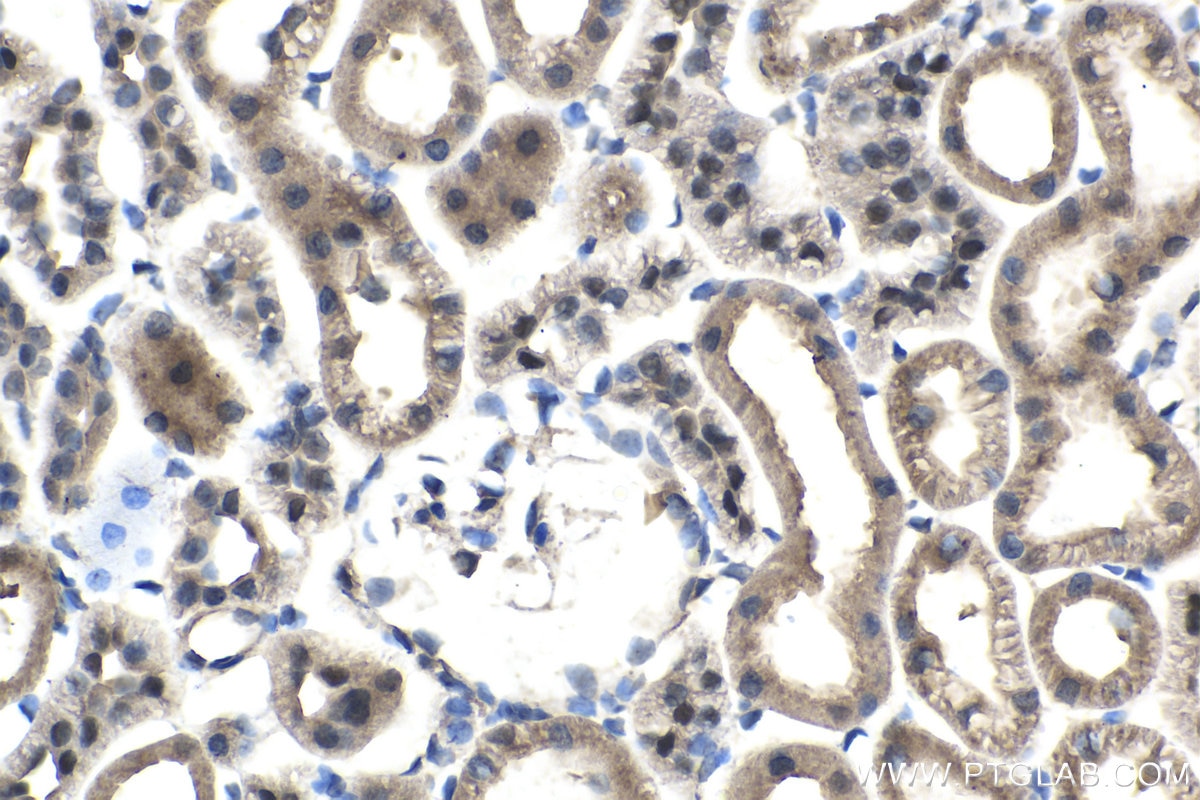 Immunohistochemical analysis of paraffin-embedded rat kidney tissue slide using KHC1499 (ESRRB IHC Kit).