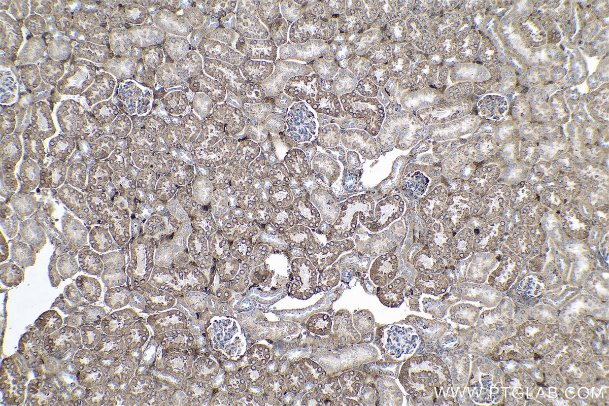 Immunohistochemical analysis of paraffin-embedded mouse kidney tissue slide using KHC0544 (ETFA IHC Kit).