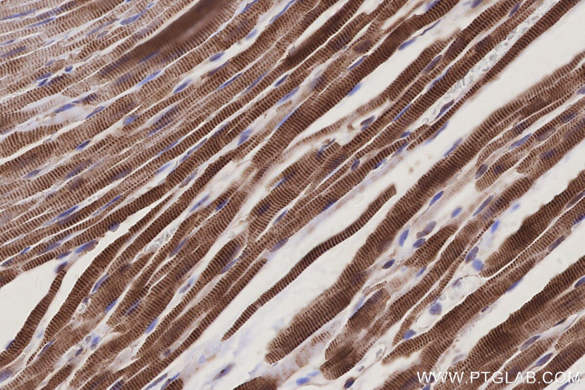 Immunohistochemical analysis of paraffin-embedded rat heart tissue slide using KHC3207 (ETFB IHC Kit).