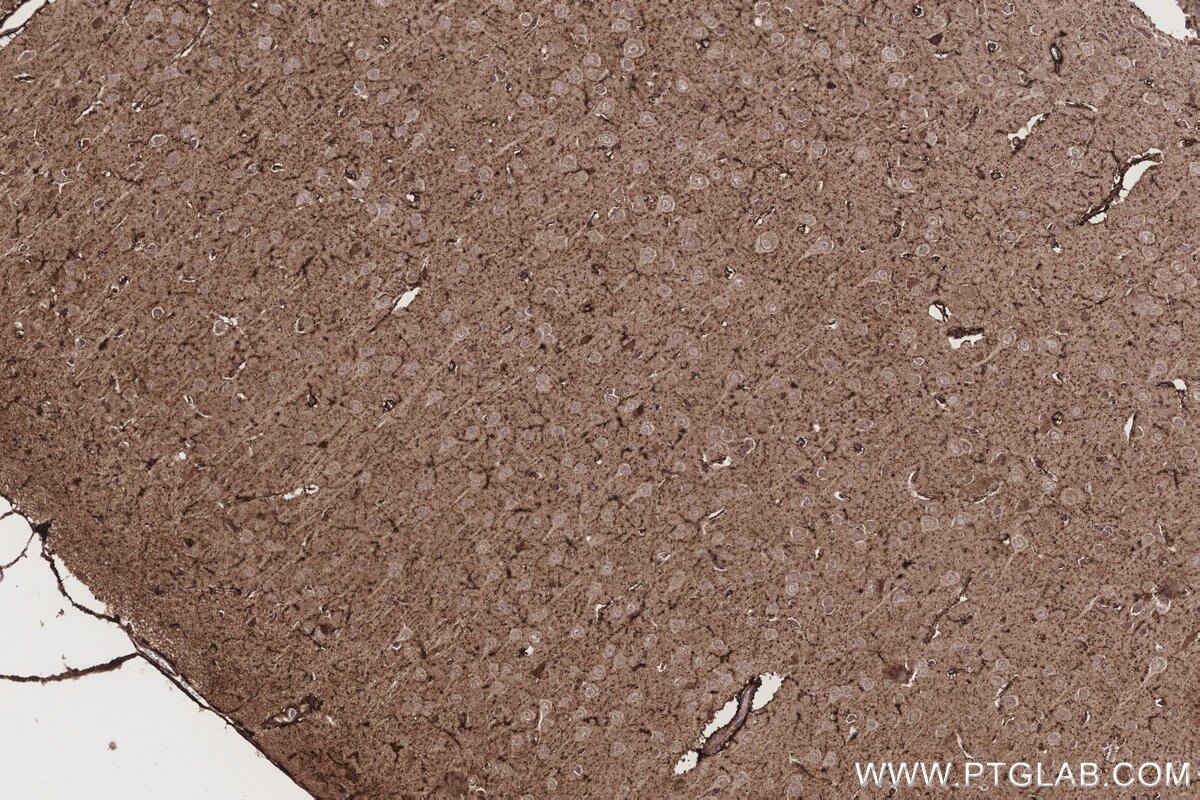 Immunohistochemical analysis of paraffin-embedded rat brain tissue slide using KHC3207 (ETFB IHC Kit).