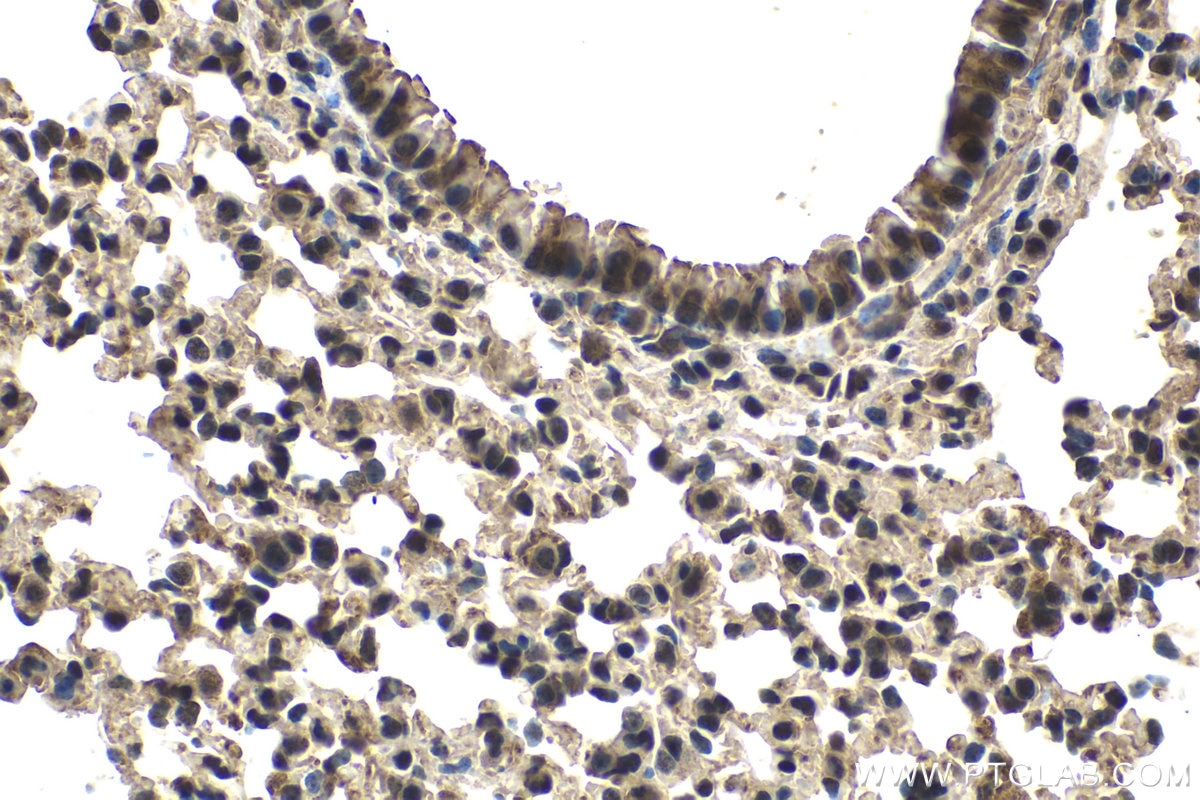 Immunohistochemical analysis of paraffin-embedded mouse lung tissue slide using KHC1533 (ETS1 IHC Kit).