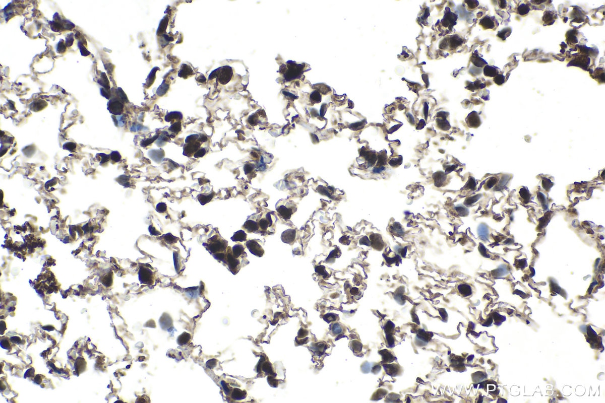 Immunohistochemical analysis of paraffin-embedded rat lung tissue slide using KHC1533 (ETS1 IHC Kit).