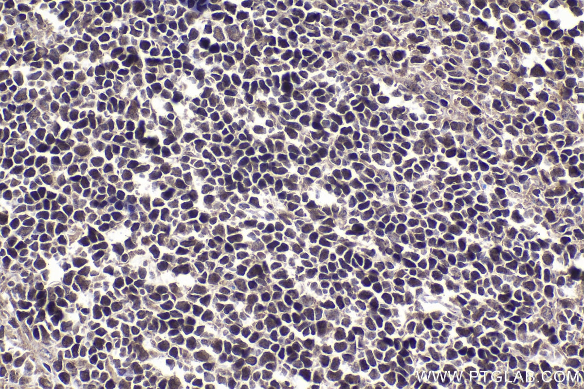 Immunohistochemical analysis of paraffin-embedded mouse spleen tissue slide using KHC1534 (ETS2 IHC Kit).
