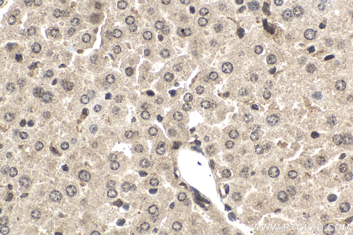 Immunohistochemical analysis of paraffin-embedded mouse liver tissue slide using KHC1534 (ETS2 IHC Kit).