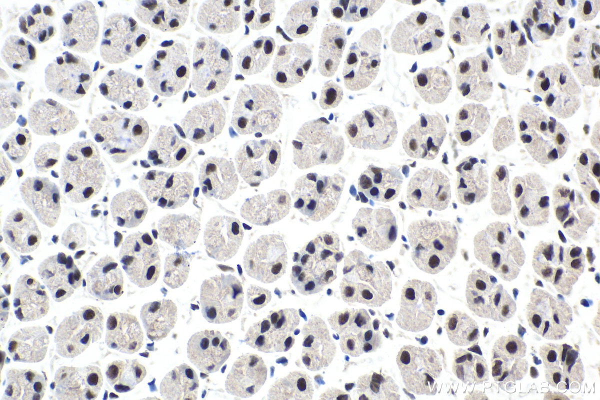 Immunohistochemical analysis of paraffin-embedded mouse stomach tissue slide using KHC1606 (ETV5 IHC Kit).