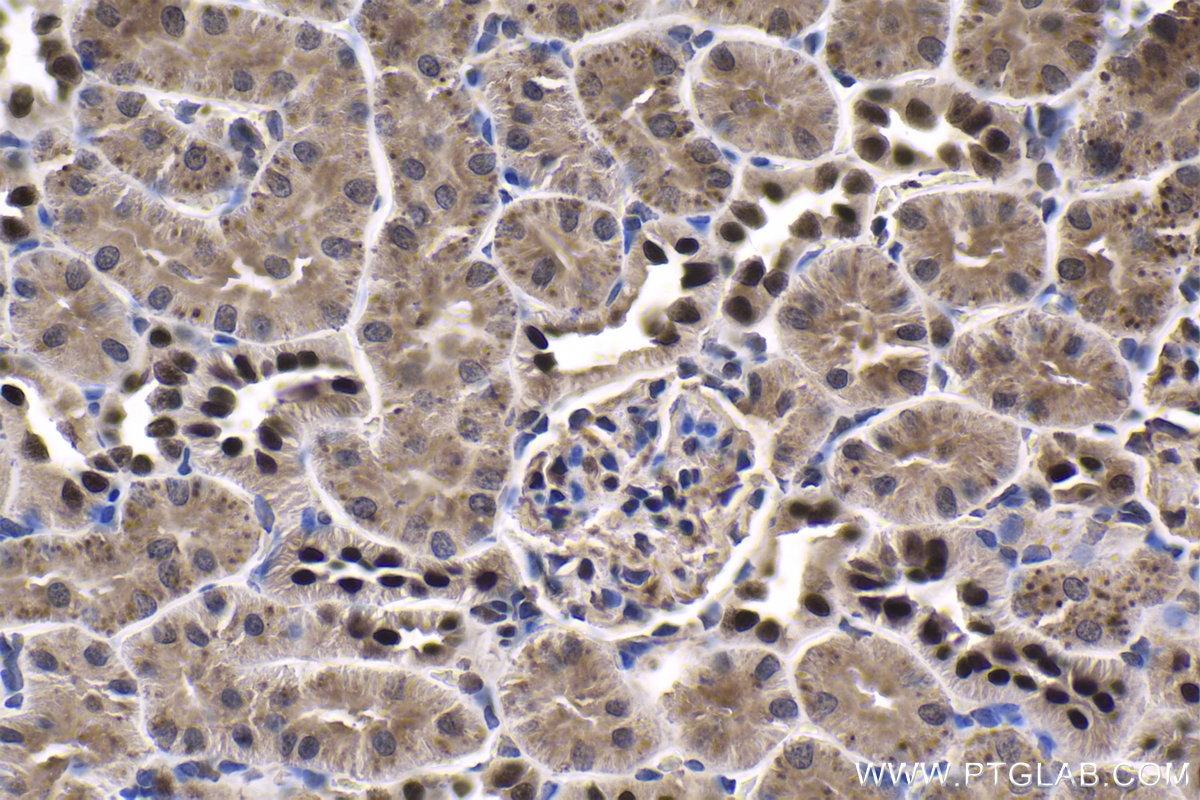 Immunohistochemical analysis of paraffin-embedded rat kidney tissue slide using KHC1672 (EVI1 IHC Kit).